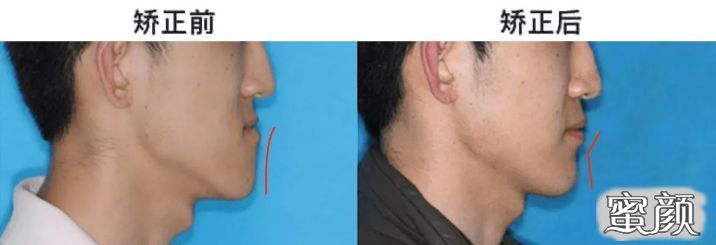 https://img.miyanlife.com/mnt/timg/200501/132A43456-17.jpg