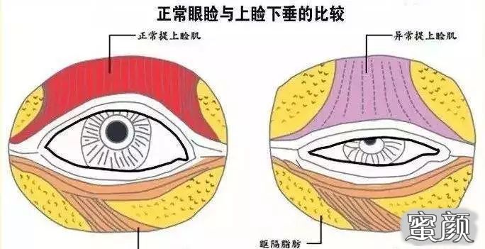 https://img.miyanlife.com/mnt/timg/200502/1111034014-1.jpg