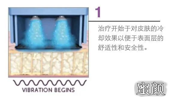 https://img.miyanlife.com/mnt/timg/200503/132113KF-8.jpg
