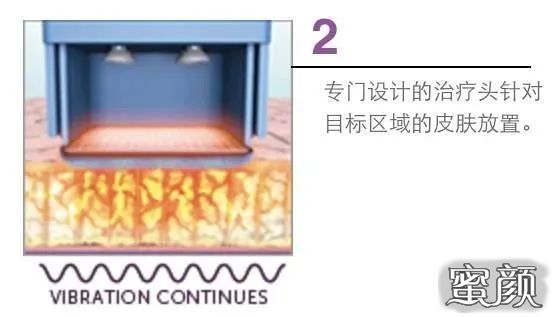 https://img.miyanlife.com/mnt/timg/200503/13211441K-9.jpg