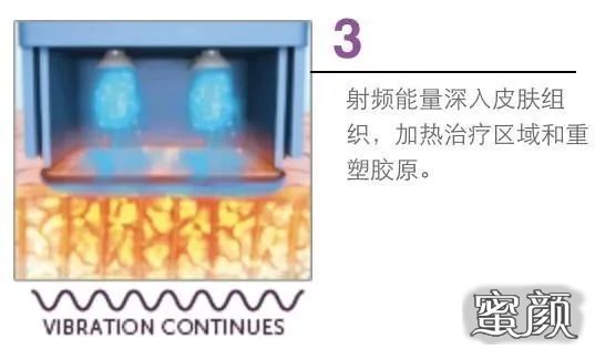 https://img.miyanlife.com/mnt/timg/200503/1321144492-10.jpg