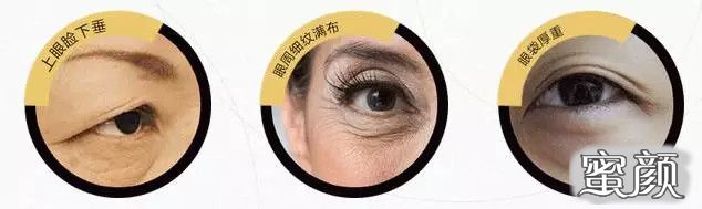 https://img.miyanlife.com/mnt/timg/200503/13211H930-13.jpg