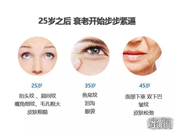 https://img.miyanlife.com/mnt/timg/200504/11331061B-0.jpg