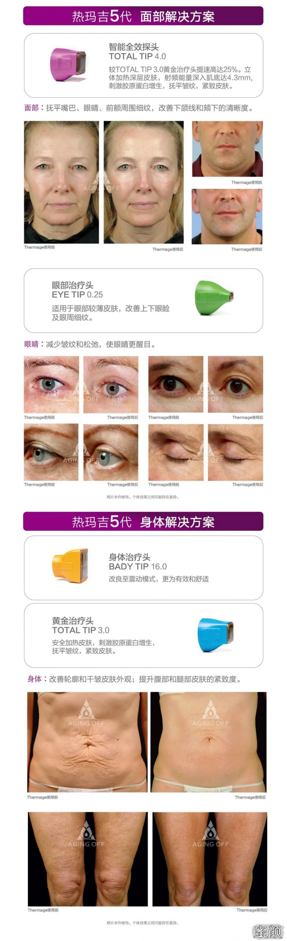 https://img.miyanlife.com/mnt/timg/200504/113330Nb-15.jpg