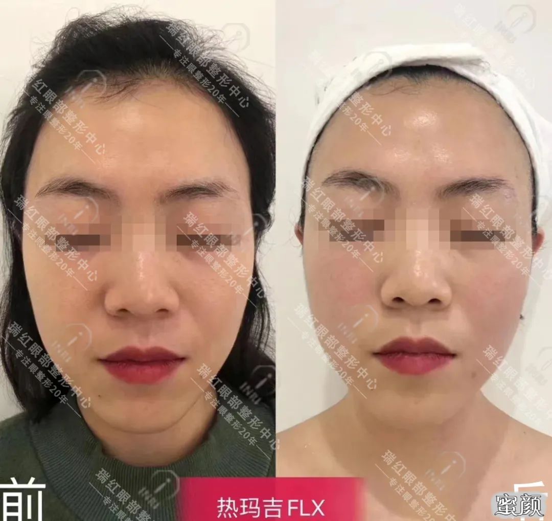 https://img.miyanlife.com/mnt/timg/200504/11334432M-5.jpg