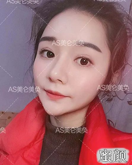 https://img.miyanlife.com/mnt/timg/200506/1405144R0-0.jpg