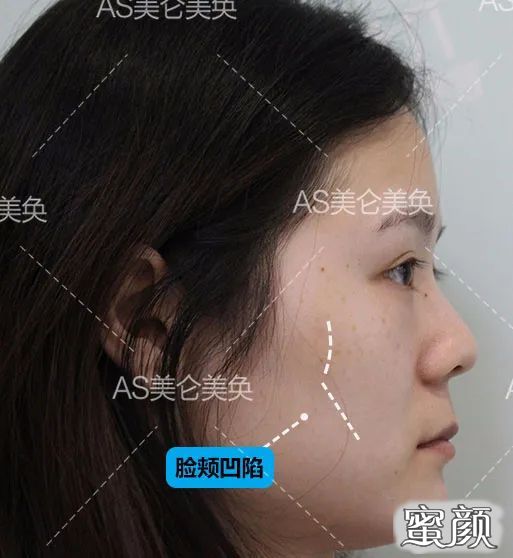 https://img.miyanlife.com/mnt/timg/200506/14051634S-1.jpg