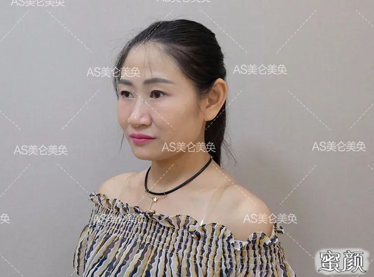 https://img.miyanlife.com/mnt/timg/200506/14052I130-5.jpg