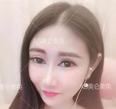https://img.miyanlife.com/mnt/timg/200506/14053041U-6.jpg