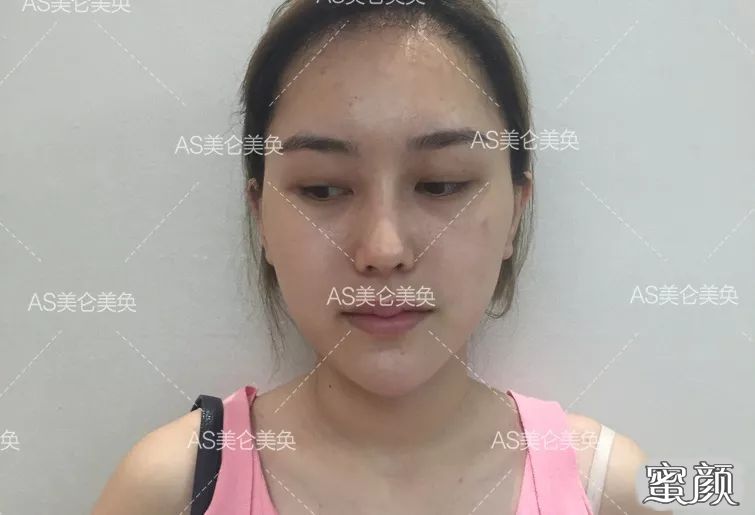 https://img.miyanlife.com/mnt/timg/200506/140531GG-7.jpg