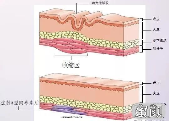 案例图片