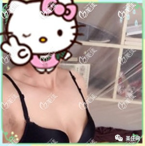 https://img.miyanlife.com/mnt/timg/200507/14400640D-0.jpg
