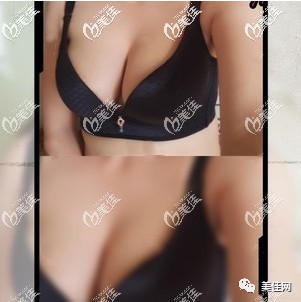 https://img.miyanlife.com/mnt/timg/200507/1440121502-5.jpg