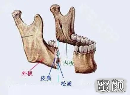 案例图片