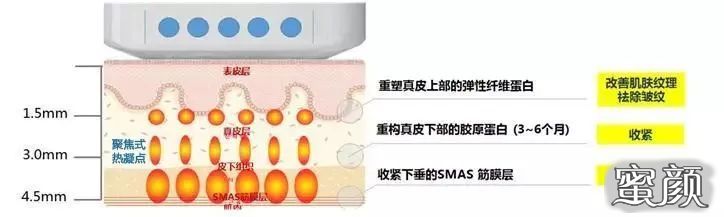 案例图片