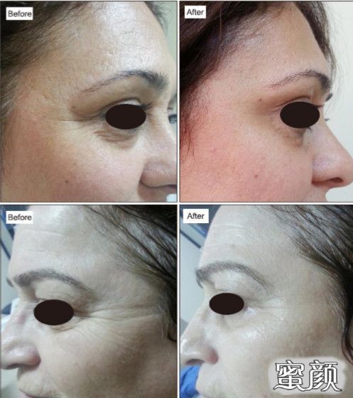 https://img.miyanlife.com/mnt/timg/200509/12542I457-5.jpg