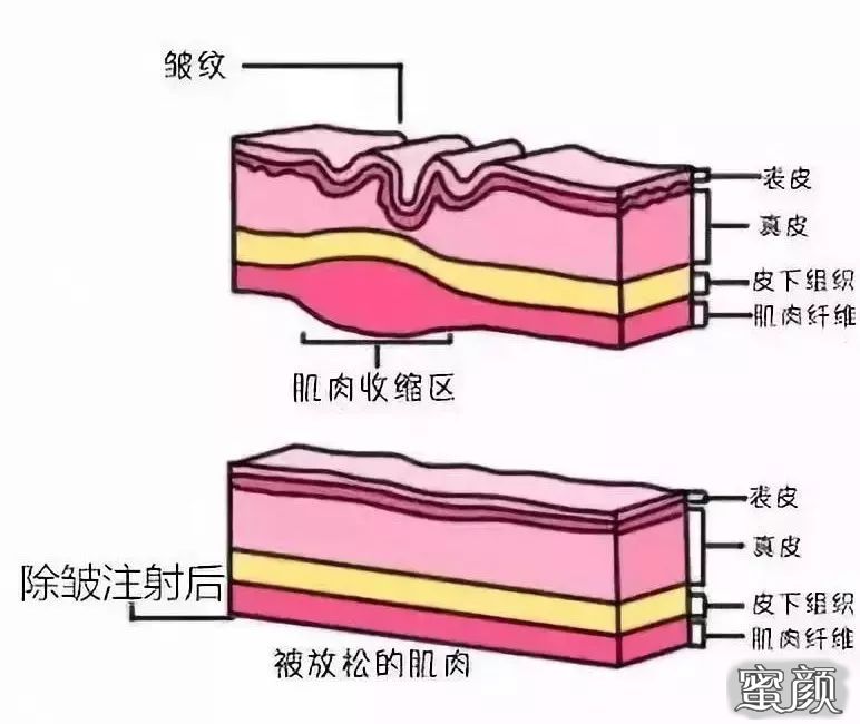 案例图片