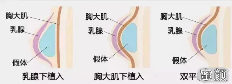 https://img.miyanlife.com/mnt/timg/200515/124FJ1K-4.jpg