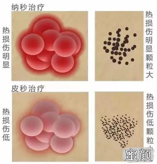 案例图片