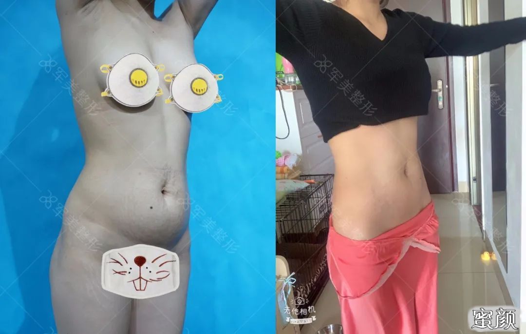 https://img.miyanlife.com/mnt/timg/200520/1F9564O1-2.jpg