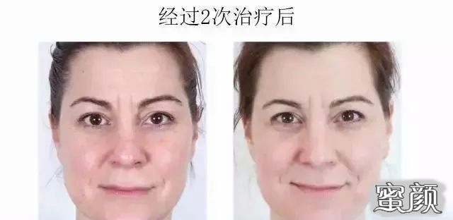 案例图片