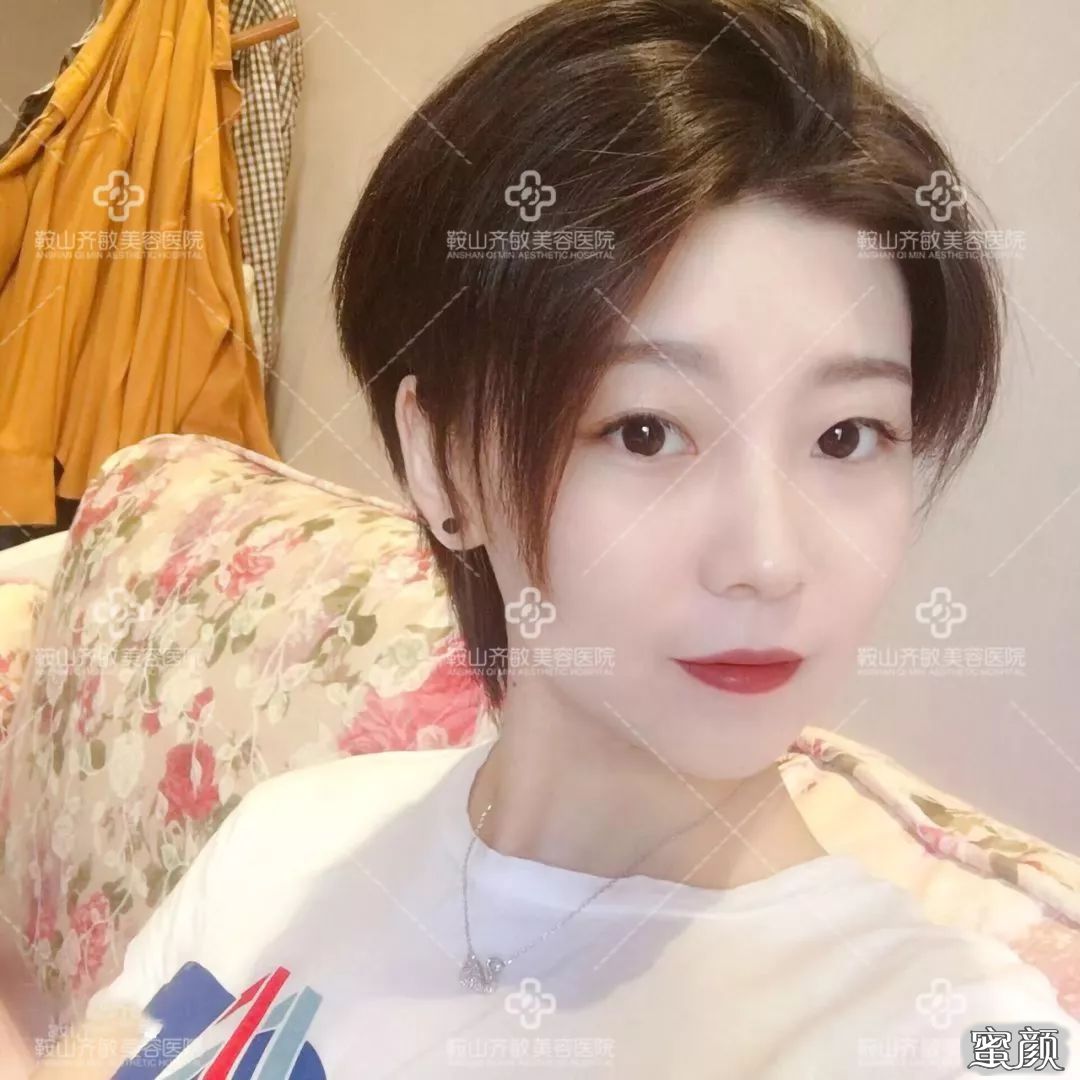 案例图片