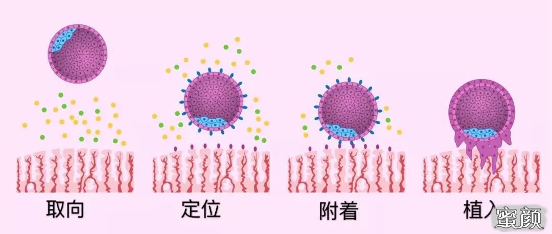 https://img.miyanlife.com/mnt/timg/200521/1644215591-1.jpg