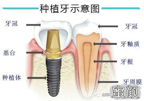 案例图片