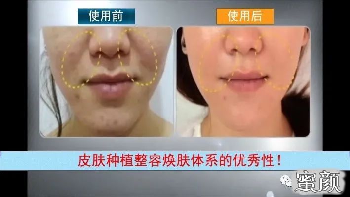 https://img.miyanlife.com/mnt/timg/200530/13044V1K-14.jpg