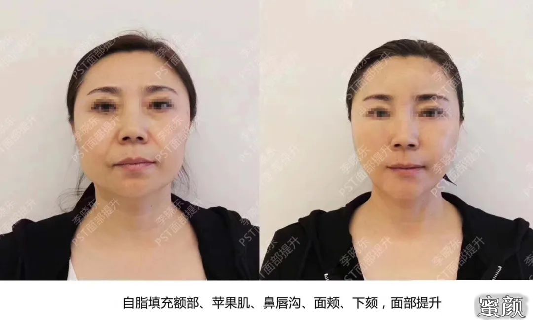 https://img.miyanlife.com/mnt/timg/200601/113P1C30-0.jpg
