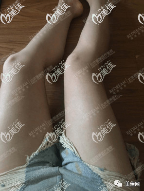 https://img.miyanlife.com/mnt/timg/200606/13094a4c-2.jpg