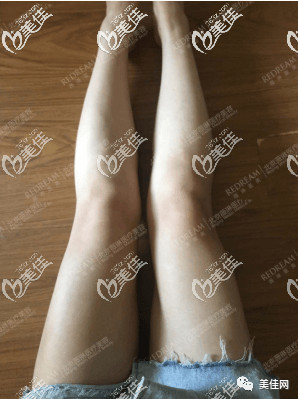 https://img.miyanlife.com/mnt/timg/200606/1309505050-3.jpg