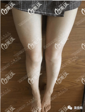 https://img.miyanlife.com/mnt/timg/200606/1309513100-4.jpg