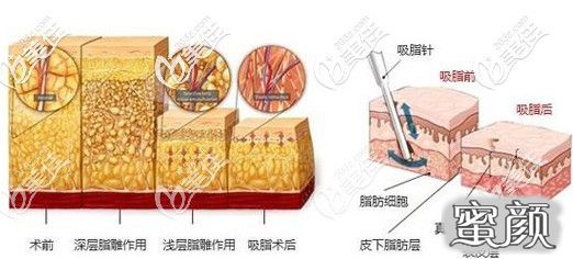 案例图片