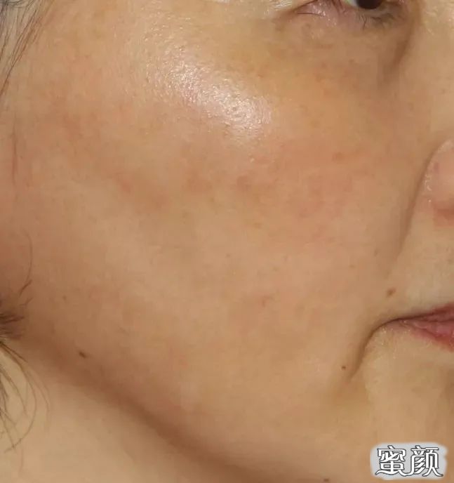 https://img.miyanlife.com/mnt/timg/200608/10541S516-2.jpg