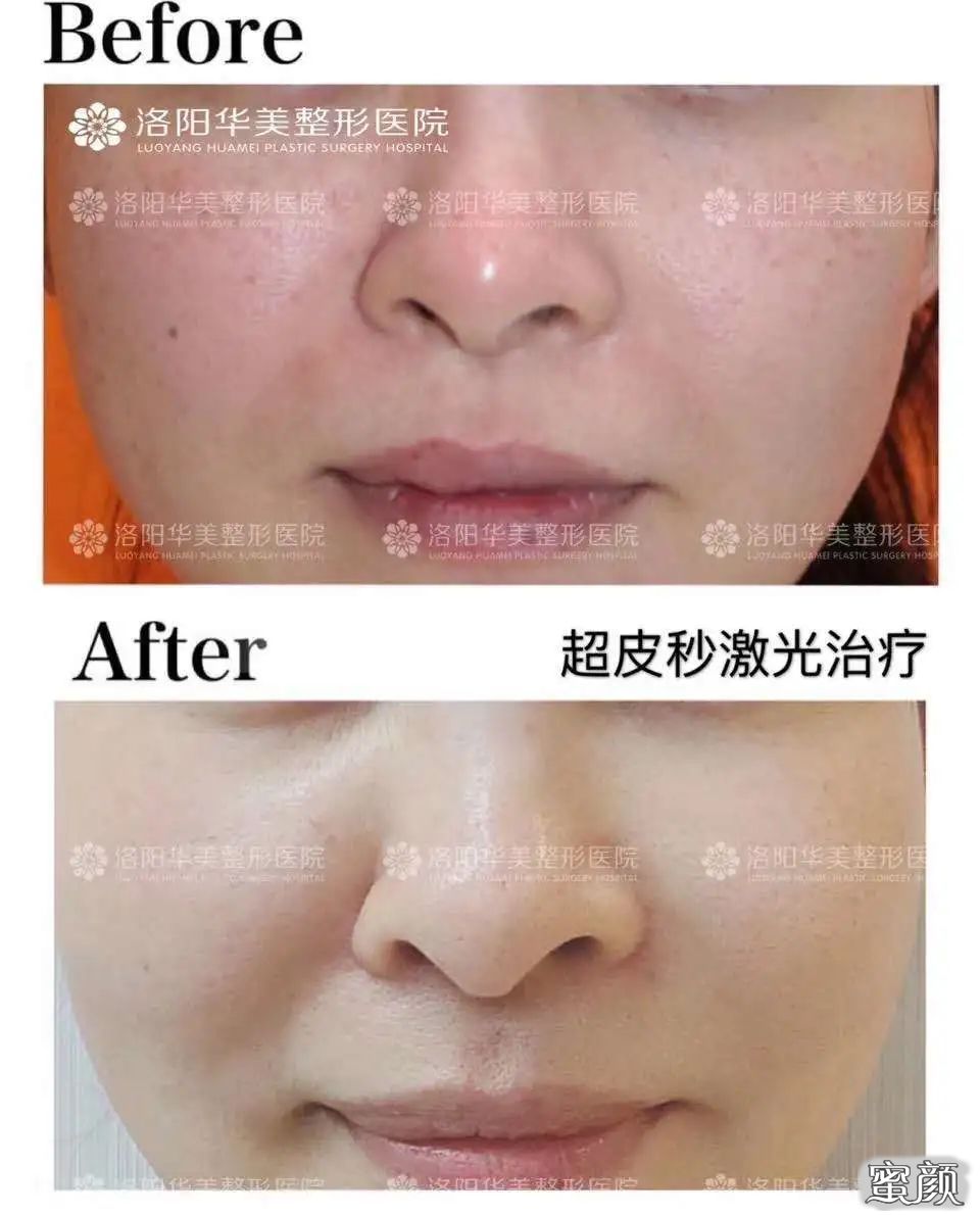 https://img.miyanlife.com/mnt/timg/200608/10541a054-5.jpg