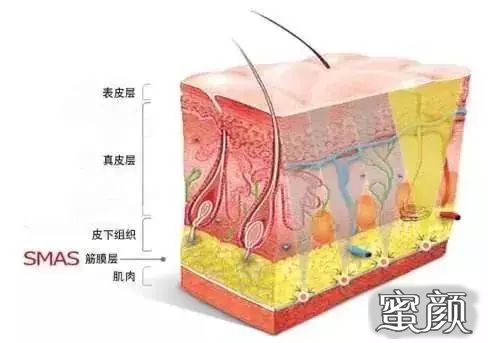 案例图片