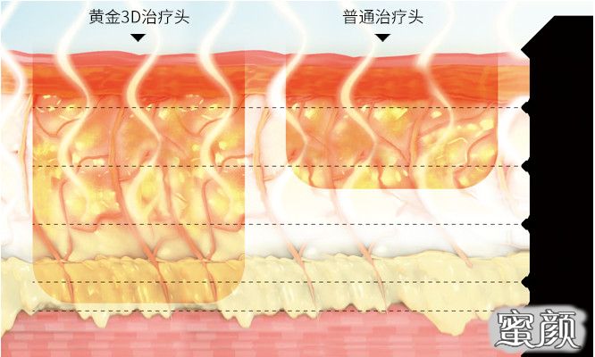 https://img.miyanlife.com/mnt/timg/200609/153J02R7-2.jpg