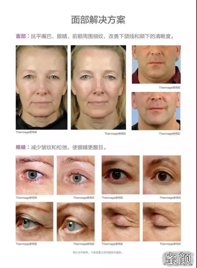 https://img.miyanlife.com/mnt/timg/200609/153J62293-5.jpg