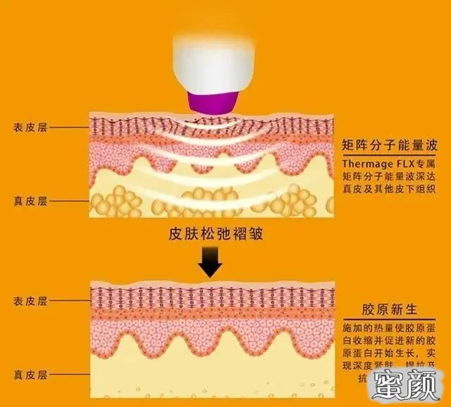 https://img.miyanlife.com/mnt/timg/200609/153UG006-1.jpg