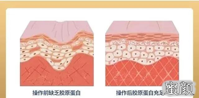 https://img.miyanlife.com/mnt/timg/200609/153UW539-3.jpg