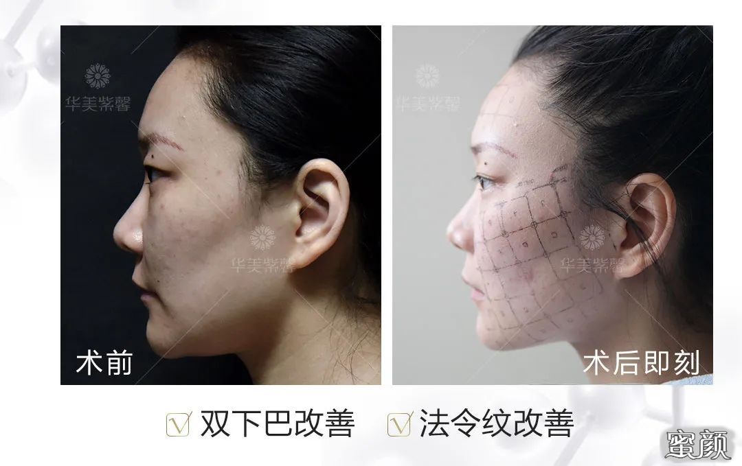 https://img.miyanlife.com/mnt/timg/200609/15404I323-8.jpg