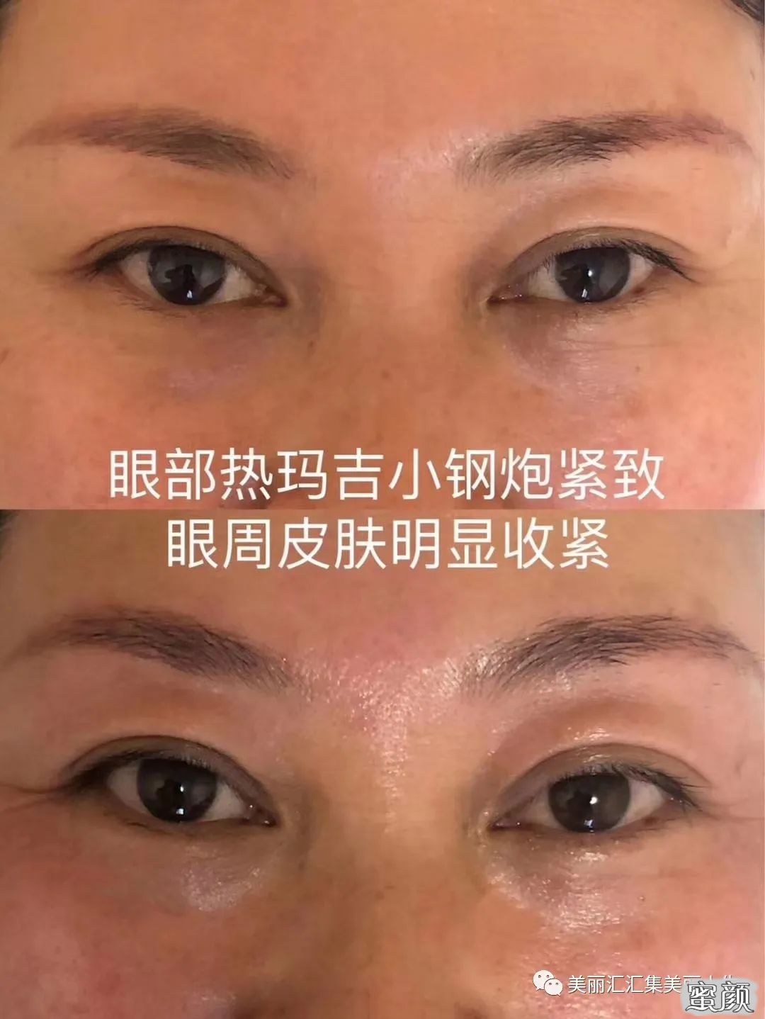 https://img.miyanlife.com/mnt/timg/200609/15430560Y-10.jpg