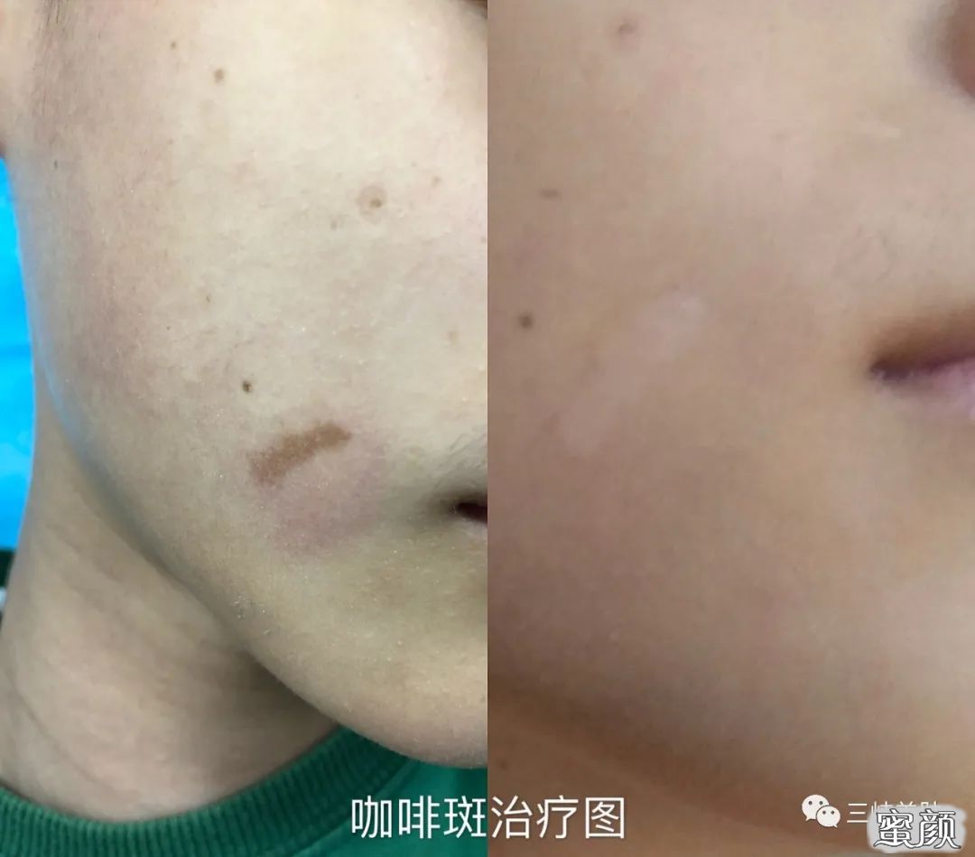 https://img.miyanlife.com/mnt/timg/200611/11192JL7-3.jpg