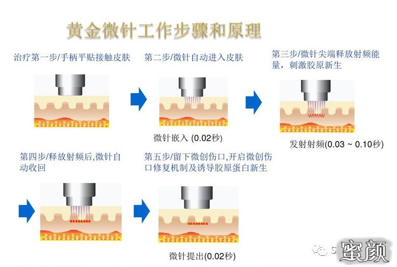 https://img.miyanlife.com/mnt/timg/200612/1214493b1-1.jpg