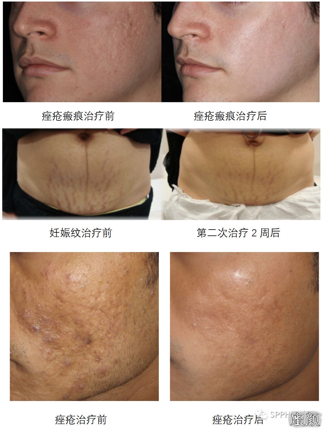 https://img.miyanlife.com/mnt/timg/200612/1215022914-3.jpg