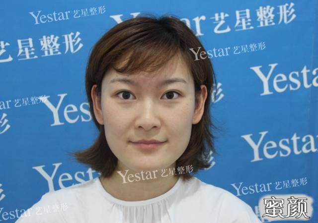 https://img.miyanlife.com/mnt/timg/200615/13295521J-12.jpg