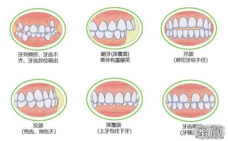 案例图片