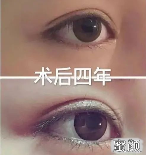 https://img.miyanlife.com/mnt/timg/200622/1234593919-3.jpg