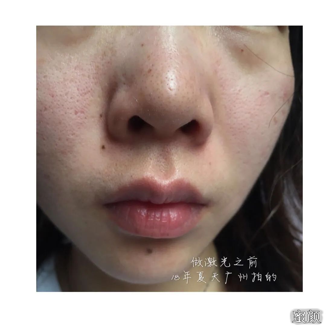 https://img.miyanlife.com/mnt/timg/200622/1241114950-1.jpg